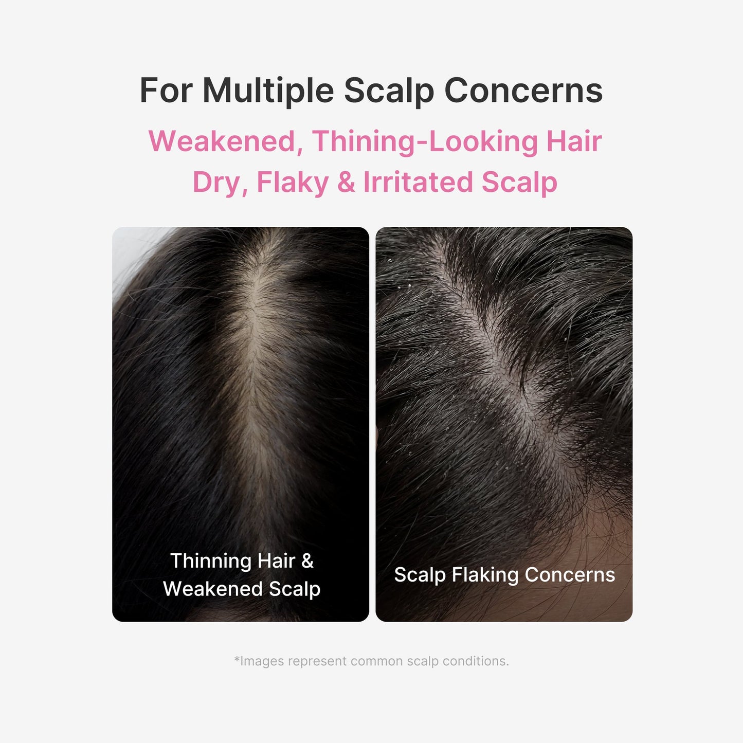 Deoxyribose Scalp Serum | For Fuller-Looking Hair & Scalp Strengthening Roll-On Serum | Deoxyribose, Rosemary, EGF, Caffeine.